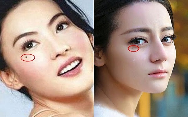 Vị trí của nốt ruồi lệ Vị trí của nốt ruồi lệ