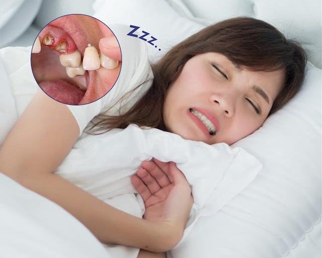 Giấc mơ lặp lại khiến bạn cảm thấy lo lắng, căng thẳng Giấc mơ lặp lại khiến bạn cảm thấy lo lắng, căng thẳng