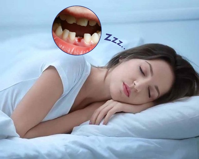 Giấc mơ thấy răng rụng cũng cho thấy những phản ứng tâm sinh lý hiện tại của cơ thể Giấc mơ thấy răng rụng cũng cho thấy những phản ứng tâm sinh lý hiện tại của cơ thể